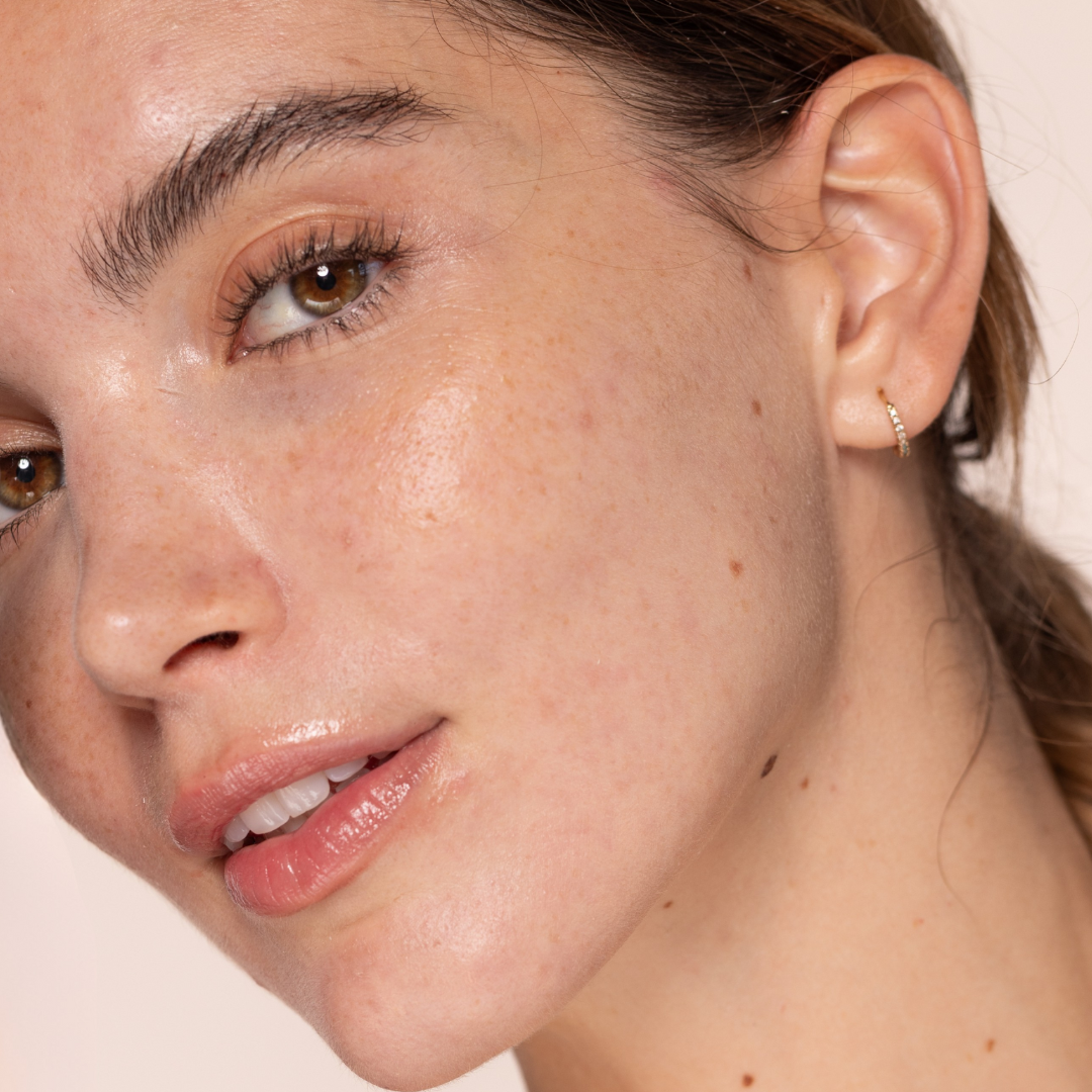 Dúo Blemish & Pores