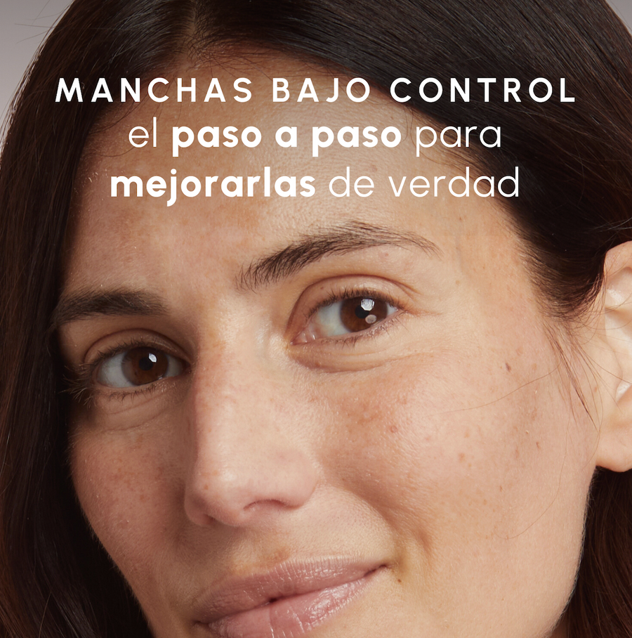 Guía para tener tus MANCHAS bajo control