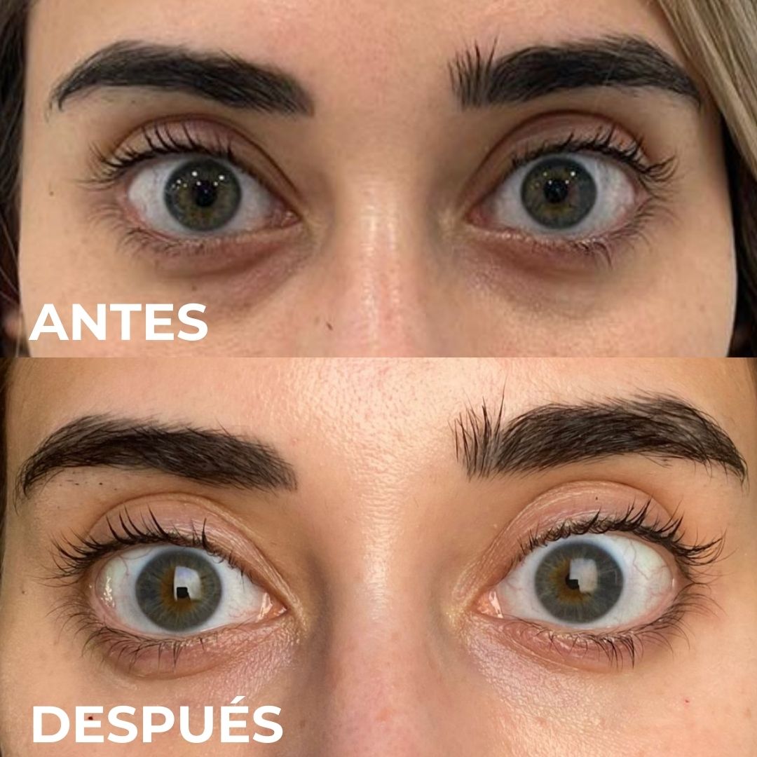 SMART EYE CREAM